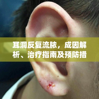 耳洞反复流脓,成因解析、治疗指南及预防措施